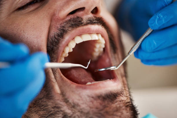 Best Cracked Tooth Emergency Dentist  in Fallston, MD