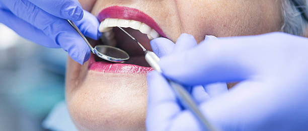 Teeth Whitening in MD